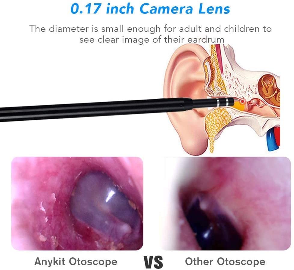 Anykit™ Multi Purpose Ear Cleaning Endoscope