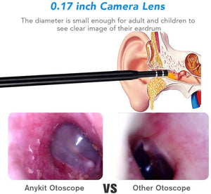 Anykit™ Multi Purpose Ear Cleaning Endoscope